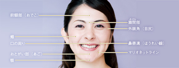 ヒアルロン酸01